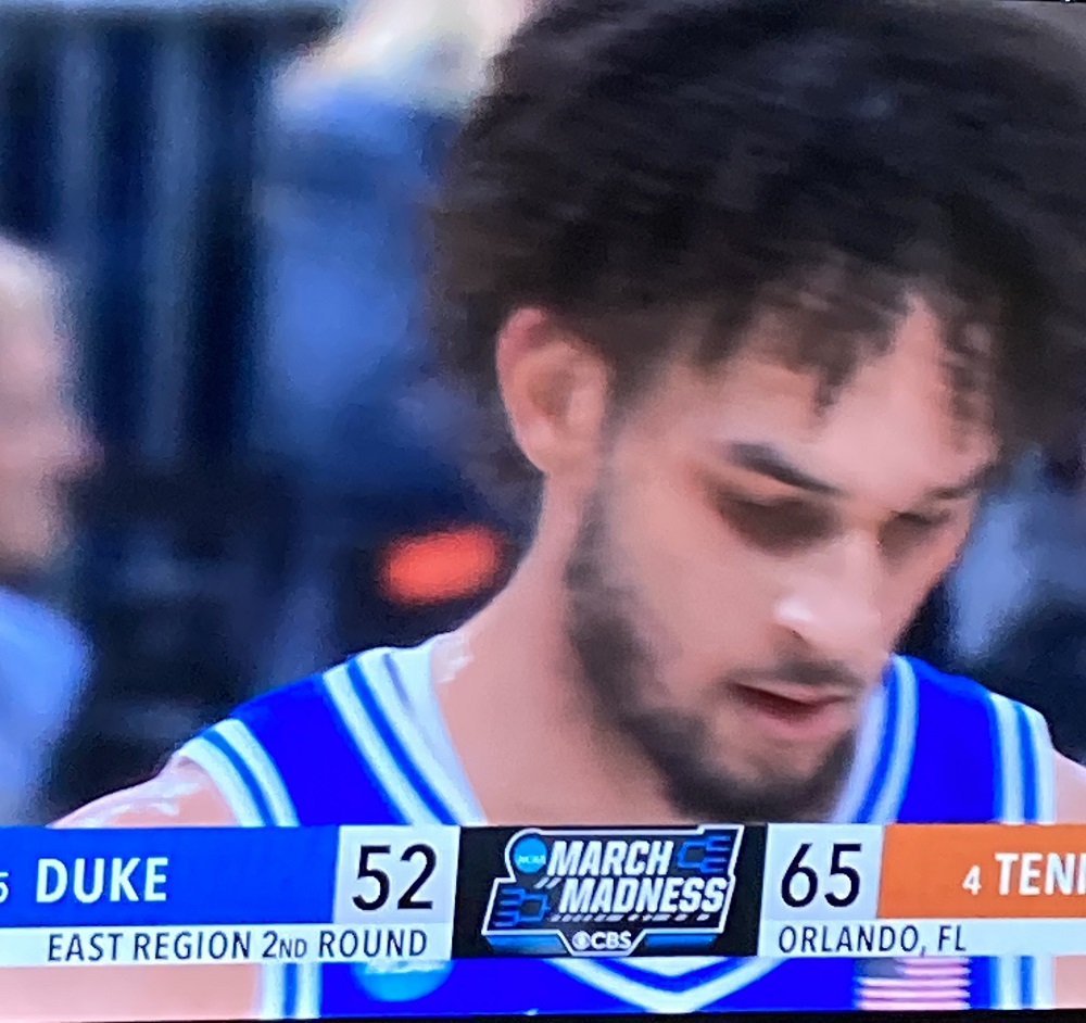 Duke Loses to Tennessee 65-52